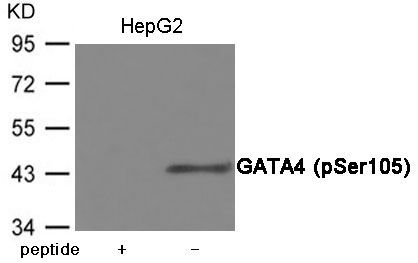 GATA4 (Phospho-Ser105) Rabbit Polyclonal Antibody, 100 ug