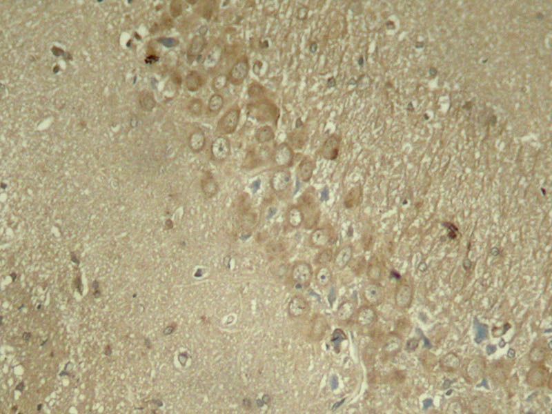 Tau (Phospho-Ser262) Rabbit Polyclonal Antibody, 100 ug