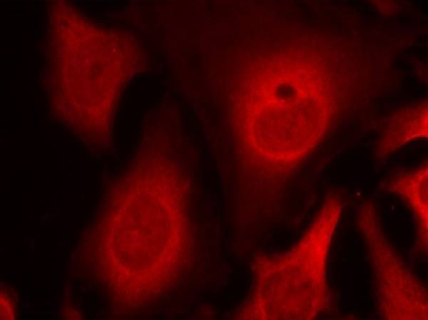 eIF2α (phospho-Ser49) Rabbit Polyclonal Antibody, 100 ug