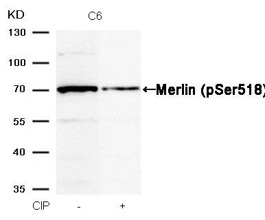 Merlin (Phospho-Ser518) Rabbit Polyclonal Antibody, 100 ug