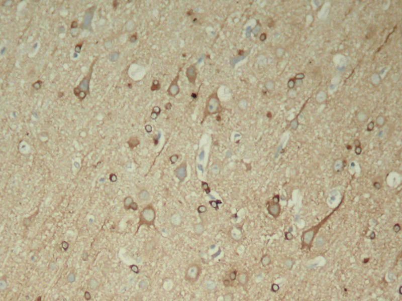 Tau (Phospho-Ser396) Rabbit Polyclonal Antibody, 100 ug