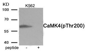 CaMK4 (Phospho-Thr200) Rabbit Polyclonal Antibody, 100 ug