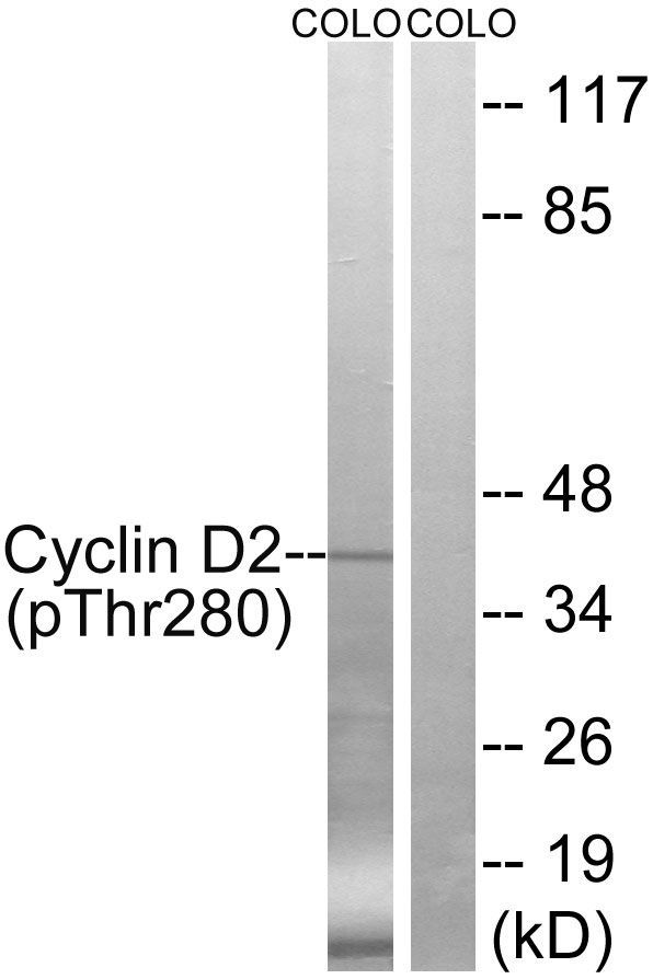 Cyclin D2 (Phospho-Thr280) Rabbit Polyclonal Antibody, 100 ug