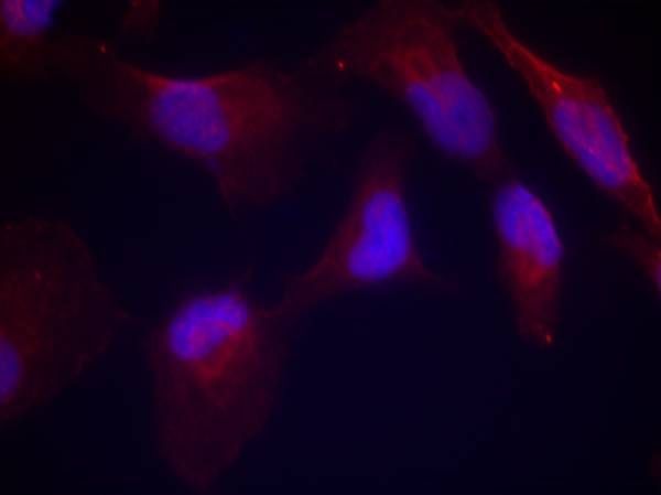 SEK1/MKK4 (Phospho-Thr261) Rabbit Polyclonal Antibody, 100 ug
