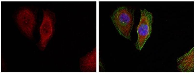 p44/42 MAP Kinase (Phospho-Thr202) Rabbit Polyclonal Antibody, 100 ug