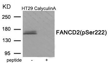 FANCD2 (Phospho-Ser222) Rabbit Polyclonal Antibody, 100 ug