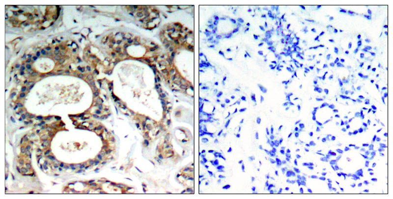 SHP-2 (Phospho-Tyr542) Rabbit Polyclonal Antibody, 100 ug