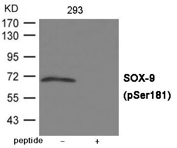 SOX-9 (Phospho-Ser181) Rabbit Polyclonal Antibody, 100 ug
