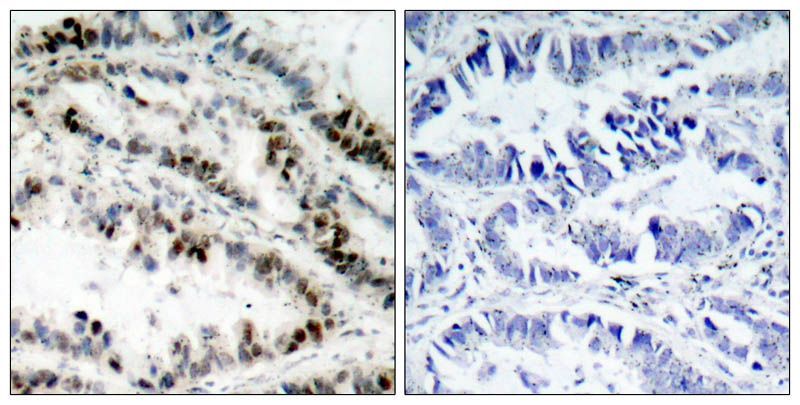 SMC1 (Phospho-Ser957) Rabbit Polyclonal Antibody, 100 ug