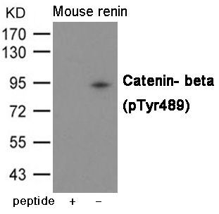 Catenin- beta (Phospho-Tyr489) Rabbit Polyclonal Antibody, 100 ug