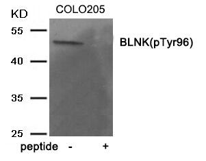 BLNK (Phospho-Tyr96) Rabbit Polyclonal Antibody, 100 ug