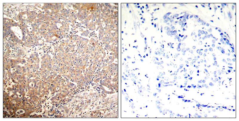 Keratin 18 (Phospho-Ser33) Rabbit Polyclonal Antibody, 100 ug