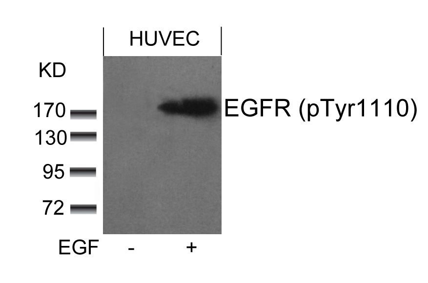 EGFR (phospho-Tyr1110) Rabbit Polyclonal Antibody, 100 ug