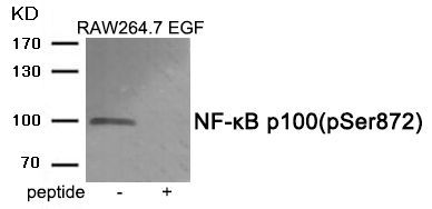 NF-κB p100 (Phospho-Ser872) Rabbit Polyclonal Antibody, 100 ug