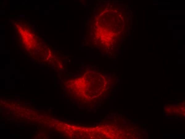Tau (Phospho-Ser356) Rabbit Polyclonal Antibody, 100 ug