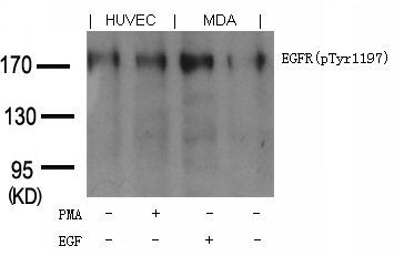 EGFR (phospho-Tyr1197) Goat Polyclonal Rabbit Polyclonal Antibody, 100 ug