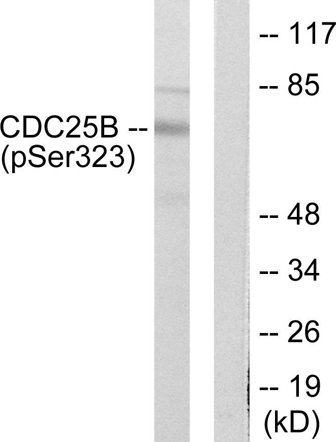 CDC25B (Phospho-Ser323) Rabbit Polyclonal Antibody, 100 ug