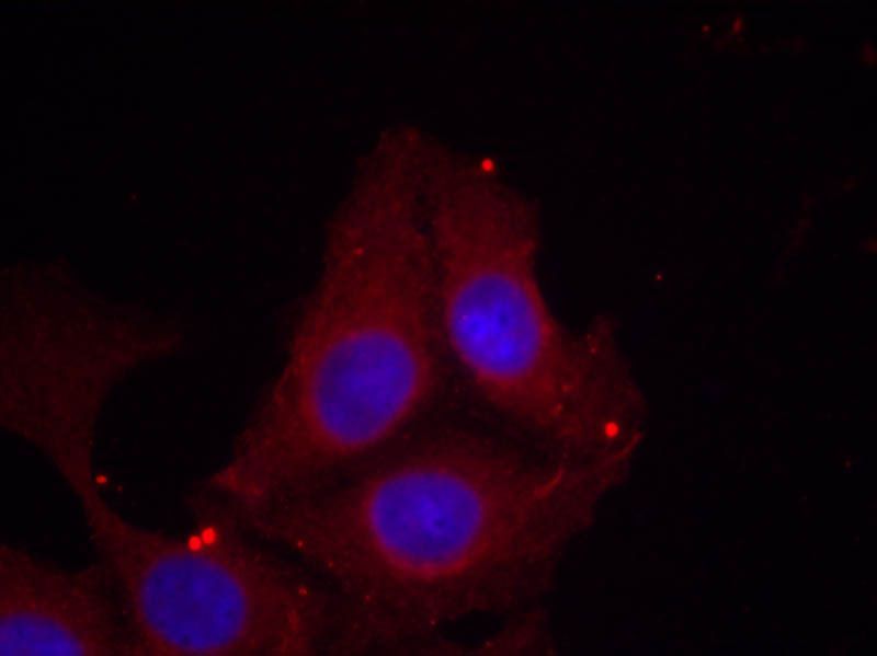 GAP43 (Phospho-Ser41) Rabbit Polyclonal Antibody, 100 ug