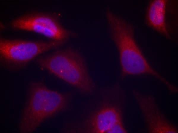 PKR (Phospho-Thr446) Rabbit Polyclonal Antibody, 100 ug