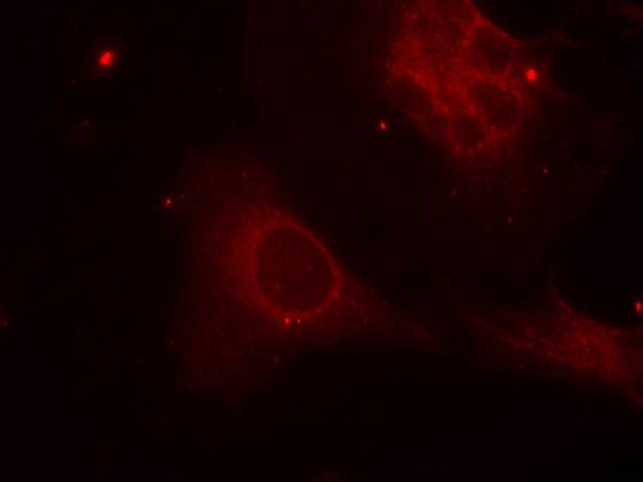 Shc1 (Phospho-Tyr349) Rabbit Polyclonal Antibody, 100 ug