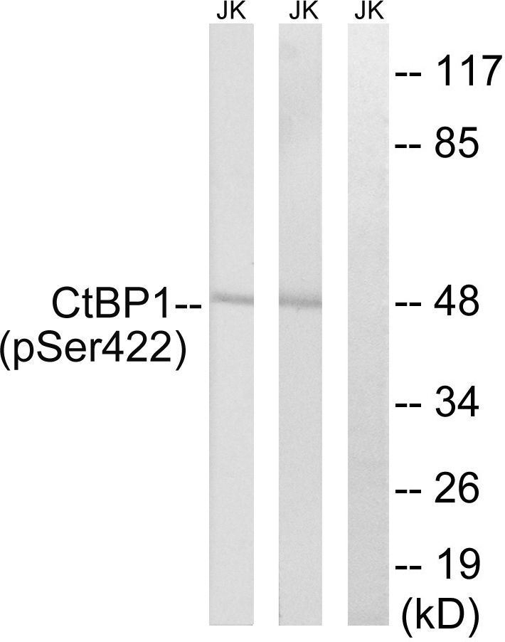CtBP1 (Phospho-Ser422) Rabbit Polyclonal Antibody, 100 ug