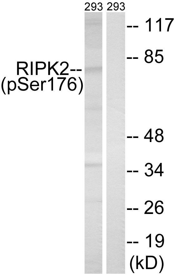 RIPK2 (Phospho-Ser176) Rabbit Polyclonal Antibody, 100 ug