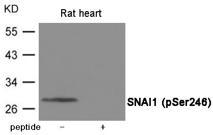 SNAI1 (Phospho-Ser246) Rabbit Polyclonal Antibody, 100 ug