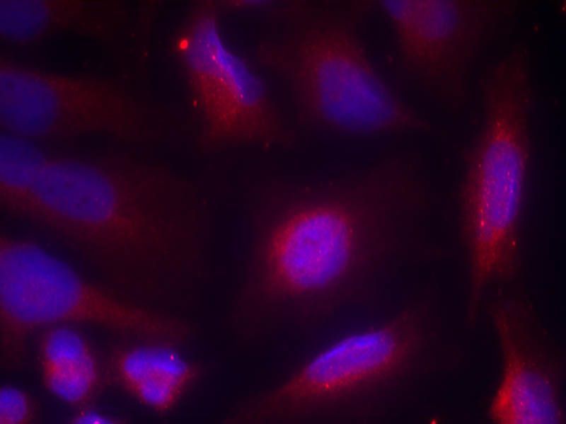 TrkA (Phospho-Ser791) Rabbit Polyclonal Antibody, 100 ug