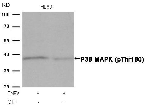 P38 MAPK (Phospho-Thr180) Rabbit Polyclonal Antibody, 100 ug