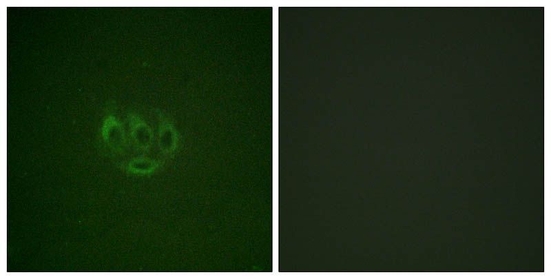 ACK1 (Phospho-Tyr284) Rabbit Polyclonal Antibody, 100 ug