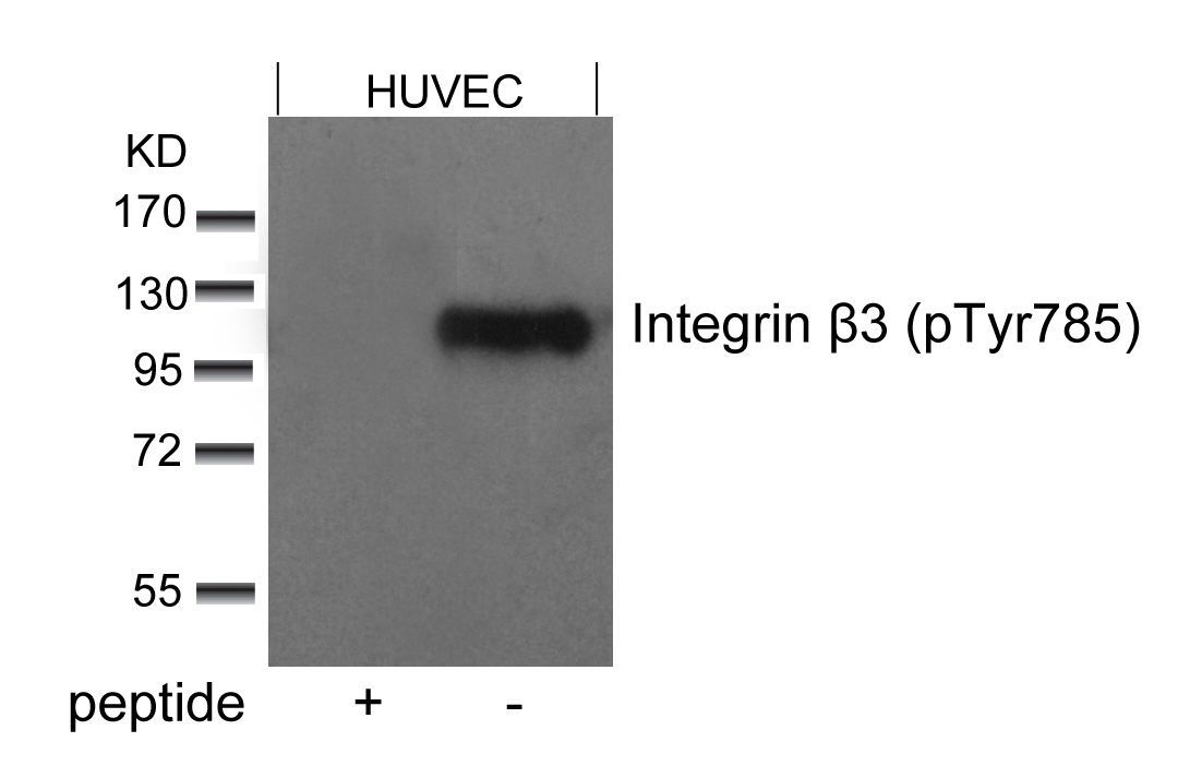 Integrin β3 (Phospho-Tyr785) Rabbit Polyclonal Antibody, 100 ug
