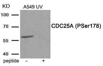 CDC25A (Phospho-Ser178) Rabbit Polyclonal Antibody, 100 ug