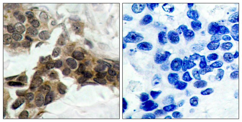 IκB-α (Phospho-Ser32/Ser36) Rabbit Polyclonal Antibody, 100 ug