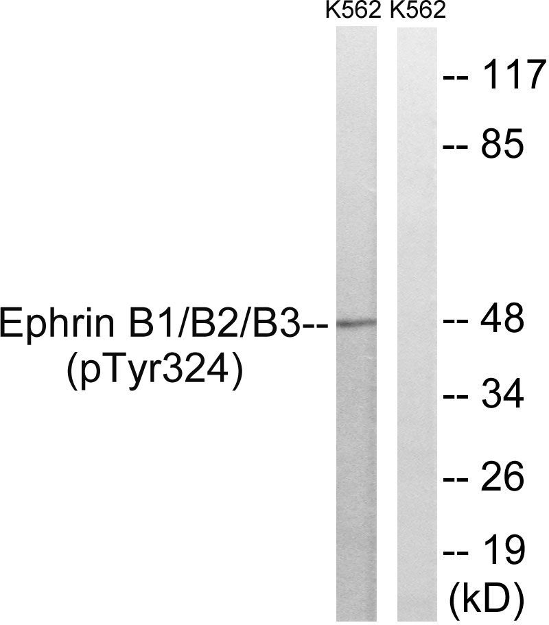 Ephrin B1/B2/B3 (Phospho-Tyr324) Rabbit Polyclonal Antibody, 100 ug