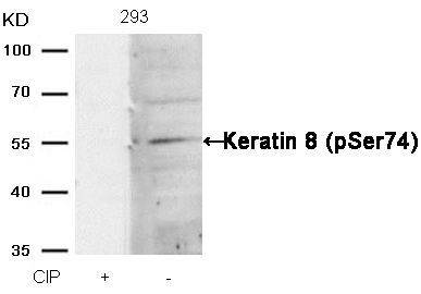 Keratin 8 (Phospho-Ser74) Rabbit Polyclonal Antibody, 100 ug