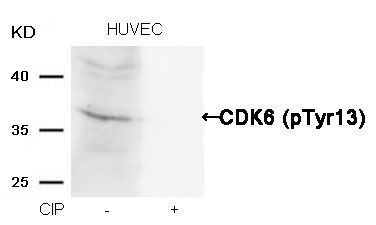CDK6 (phospho-Tyr13) Rabbit Polyclonal Antibody, 100 ug