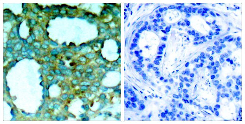 PAK1 (Phospho-Thr212) Rabbit Polyclonal Antibody, 100 ug