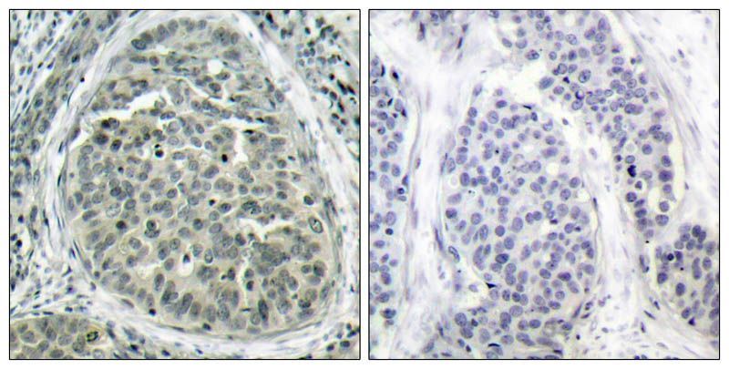 β-Catenin (Phospho-Ser37) Rabbit Polyclonal Antibody, 100 ug