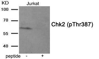 Chk2 (Phospho-Thr387) Rabbit Polyclonal Antibody, 100 ug