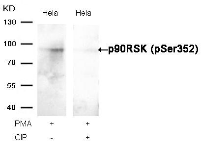 p90RSK (Phospho-Ser352) Rabbit Polyclonal Antibody, 100 ug