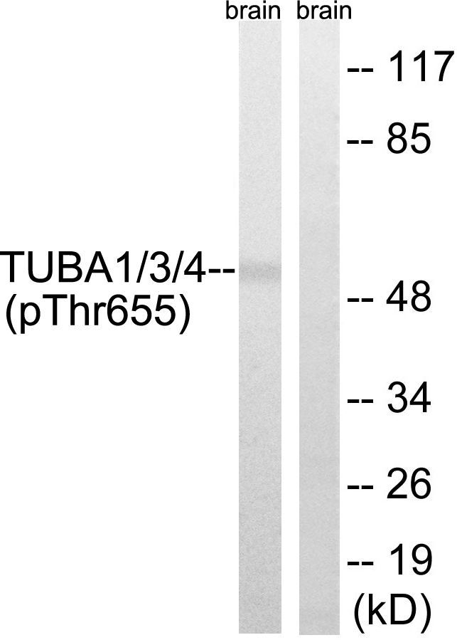 TUBA1/3/4 (Phospho-Tyr272) Rabbit Polyclonal Antibody, 100 ug