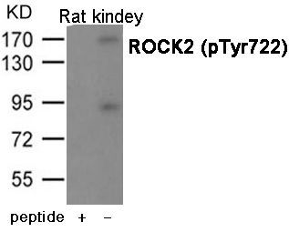 ROCK2 (Phospho-Tyr722) Rabbit Polyclonal Antibody, 100 ug