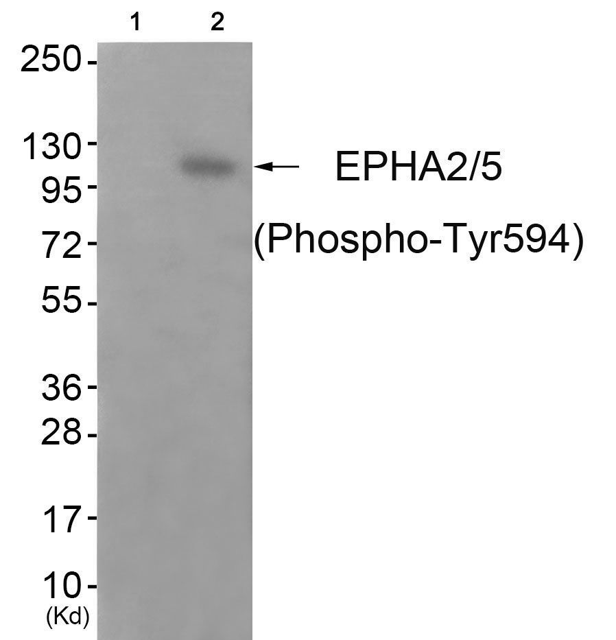 EPHA2/5 (Phospho-Tyr594) Rabbit Polyclonal Antibody, 100 ug