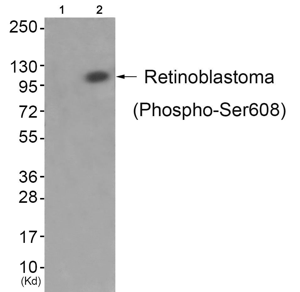 Retinoblastoma (Phospho-Ser608) Rabbit Polyclonal Antibody, 100 ug