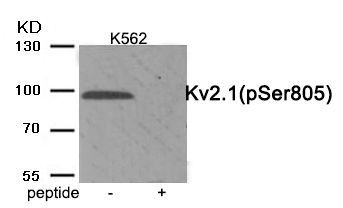 Kv2.1 (Phospho-Ser805) Rabbit Polyclonal Antibody, 100 ug