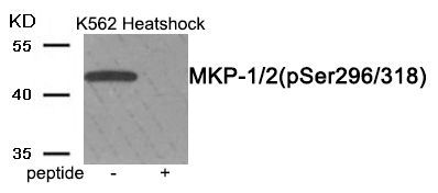 MKP-1/2 (Phospho-Ser296/318) Rabbit Polyclonal Antibody, 100 ug
