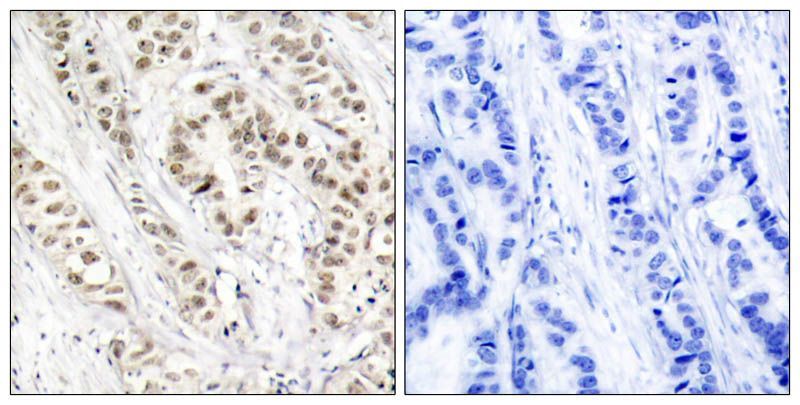 BRCA1 (Phospho-Ser1524) Rabbit Polyclonal Antibody, 100 ug