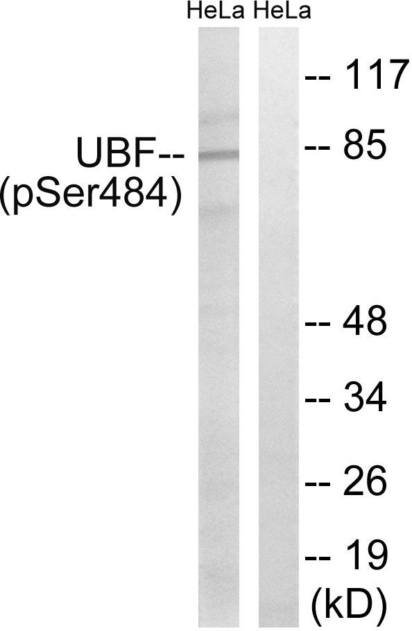 UBF (Phospho-Ser484) Rabbit Polyclonal Antibody, 100 ug