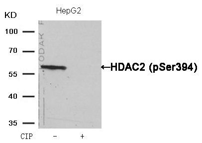 HDAC2 (Phospho-Ser394) Rabbit Polyclonal Antibody, 100 ug