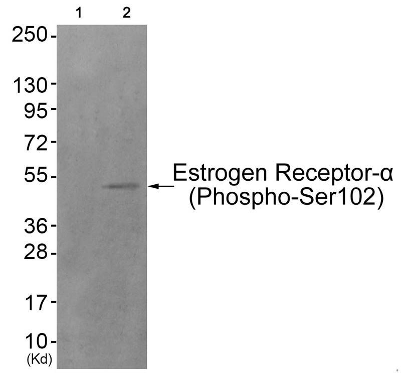 Estrogen Receptor-α (Phospho-Ser102) Rabbit Polyclonal Antibody, 100 ug